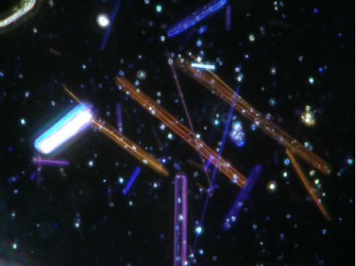 石綿(アモサイト)顕微鏡写真